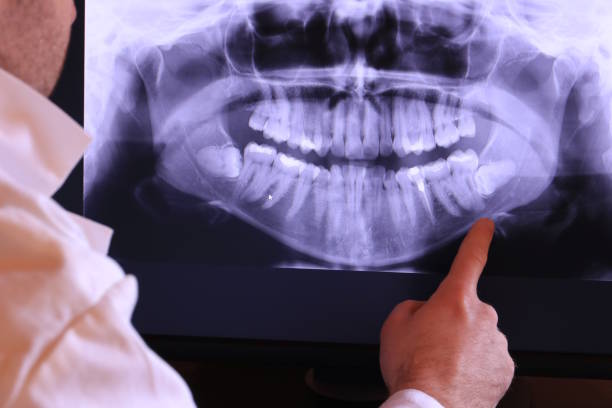 Best Emergency Gum Treatment in Cottage Grove, MN