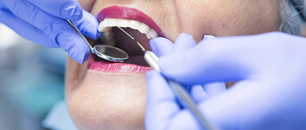 Best Emergency Treatment for Dental Infections or Abscesses in Cottage Grove, MN